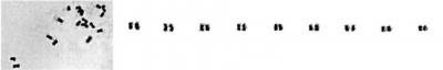 Karyotype