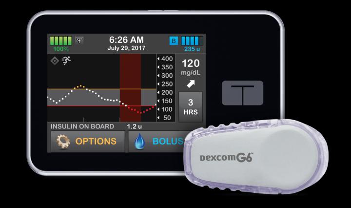 Control-IQ Diabetes Management System