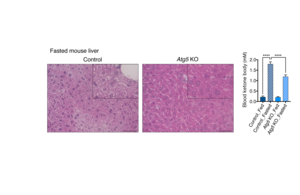Fig.2 Suppression of autophagy in adipose tissue decreases hepatic steatosis and ketogenesis during fasting.