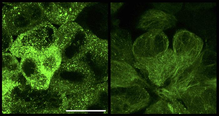 Tau aggregates before and after