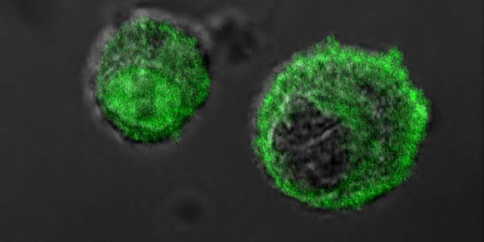 Adaptable cancer cells