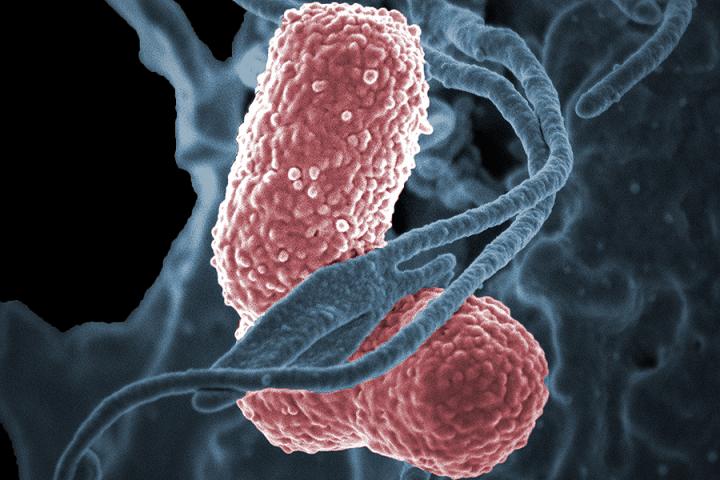 <i>Klebsiella pneumoniae</i>