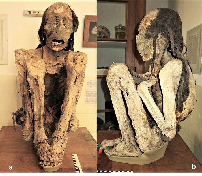 Marburg mummy