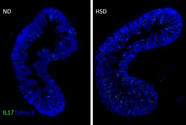 Intestinal Layer that Absorbs Digested Food
