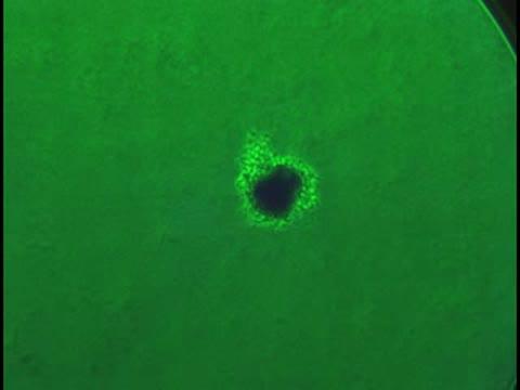 Video: Bacterial Colony (1 of 2)