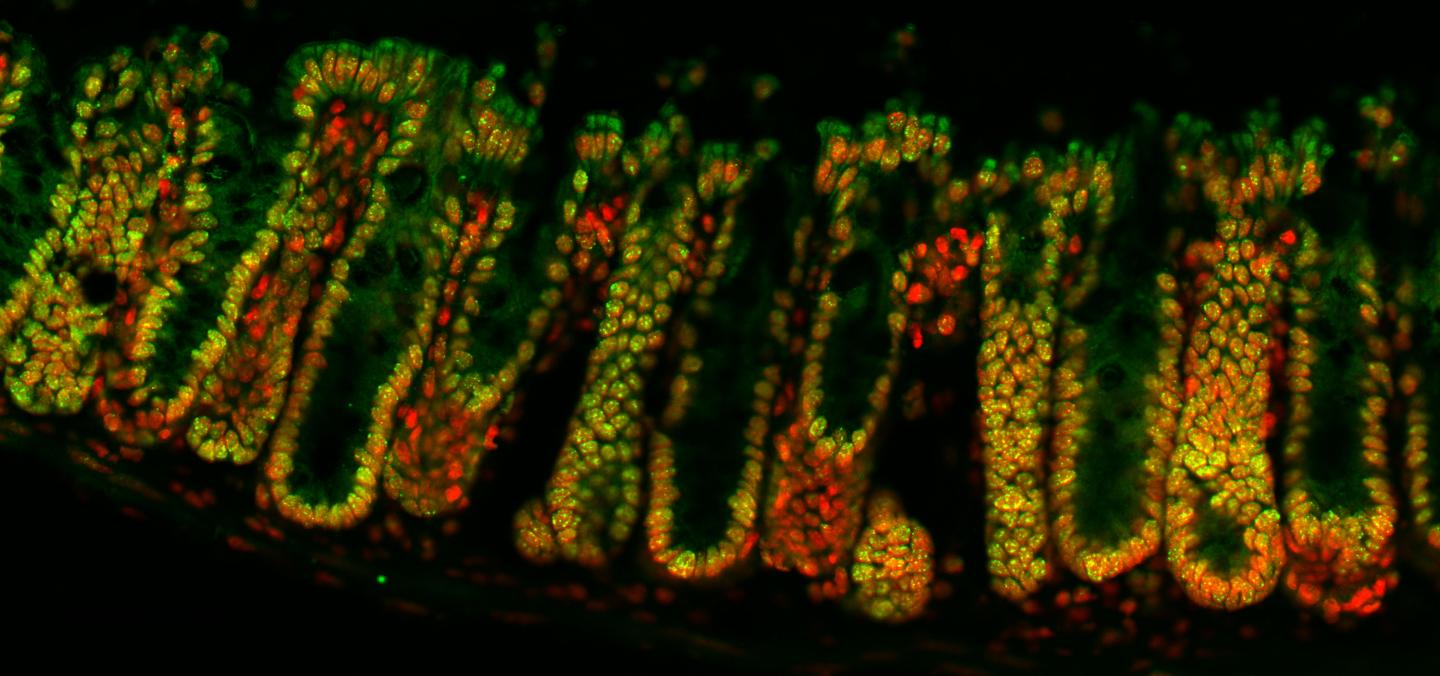 Epigenetic Markers in Cells Lining the Large Intestine