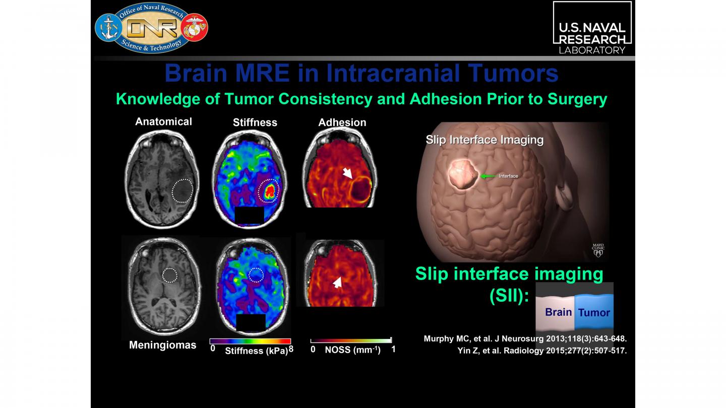 Noninvasive Way to Explore Traumatic Brain Injuries