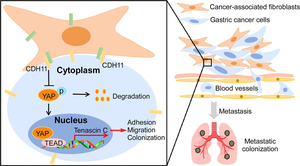 A model illustrating the crucial role of CDH11 in GC cell-fibroblast juxtacrine interactions and its impact on metastasis