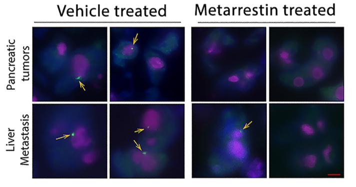 A New Tool in the Fight Against Cancer Metastasis (2 of 2)