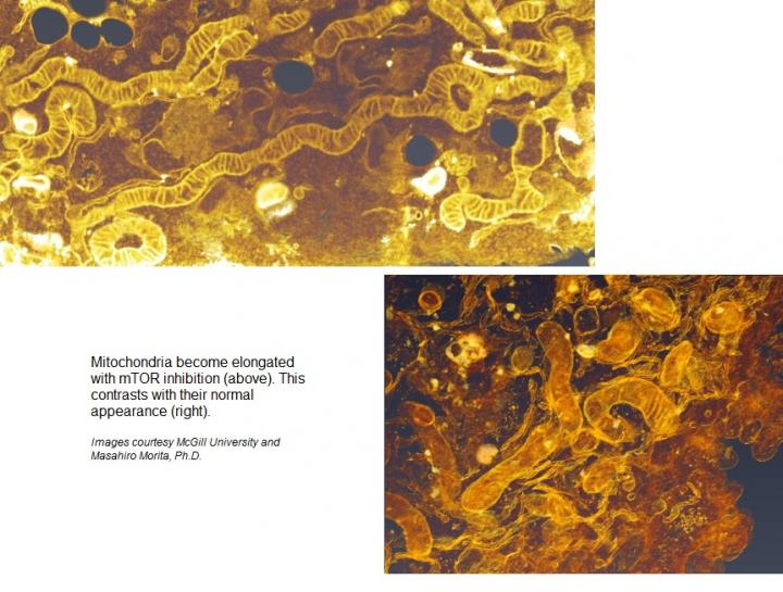 mTOR inhibition Alters Mitochondria