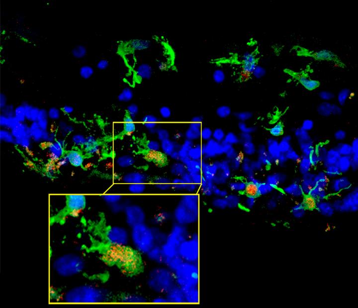 C3 Expression Occurs in Context of Photoreceptor Degeneration