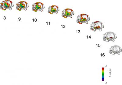 Composite 3-D MRI Scan Data for Youth, Ages 8-16