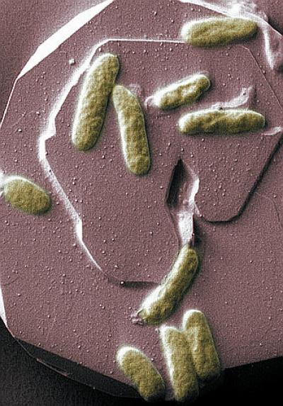 Shewanella oneidensis MR-1