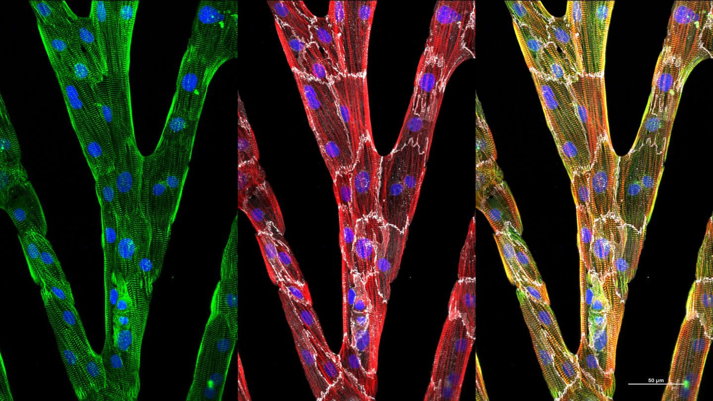 Three Images Show Individual Heart Cells