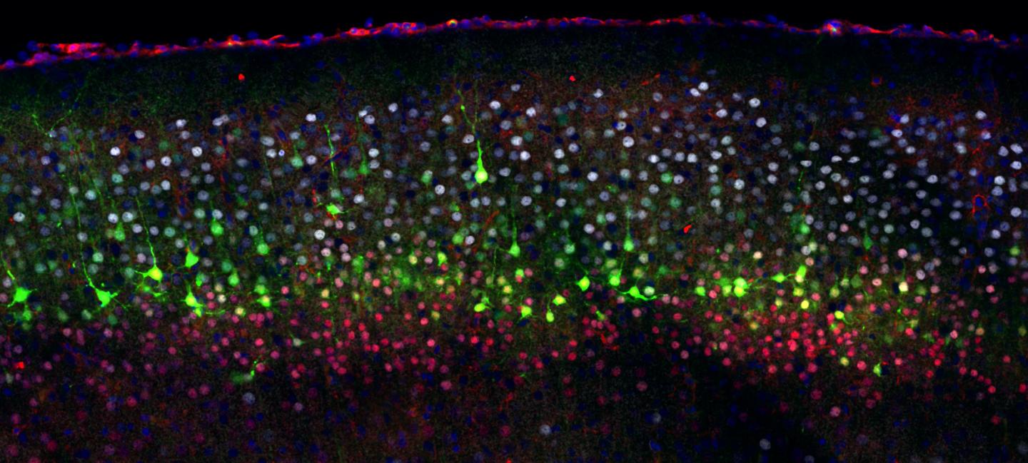 The Diversity of Cortical Neurons