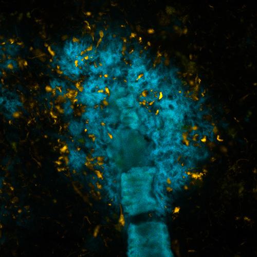 Staining of Protein Plaques i Brain Tissue