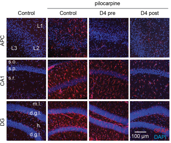 D4 treatment decreases the proliferation and activation of astrocytes in two different brain regions