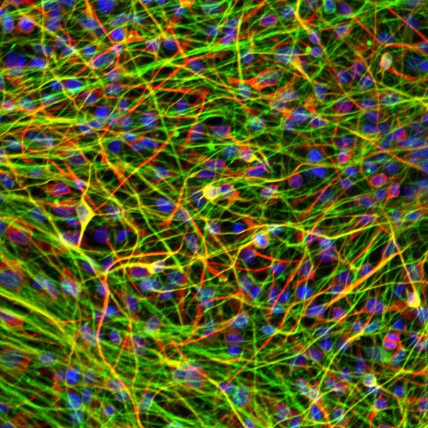 Neurons Derived from Induced Pluripotent Stem Cells from a Schizophrenia Patient