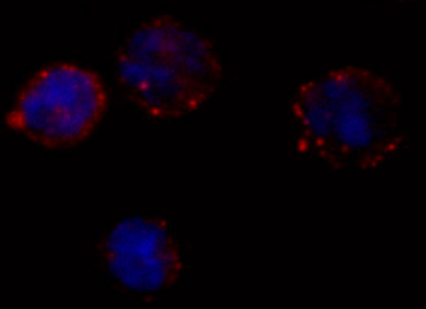 CLL Cells Expressing CD49d