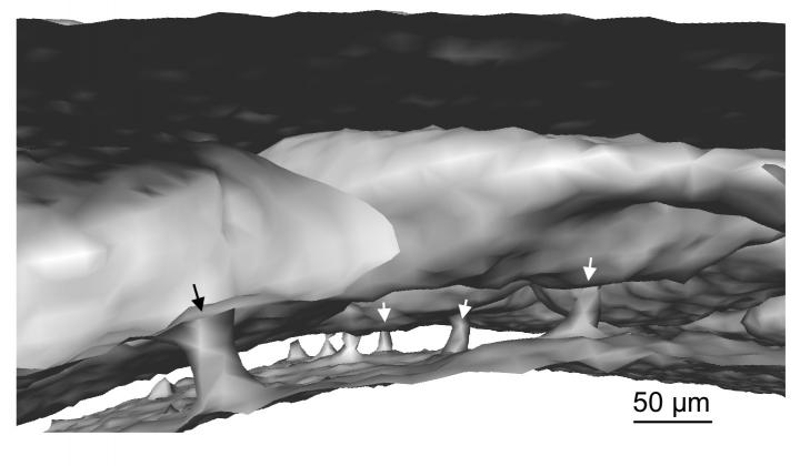 Micro CT of Channels Connecting Skull Bone Marrow to Outer Surface of Brain