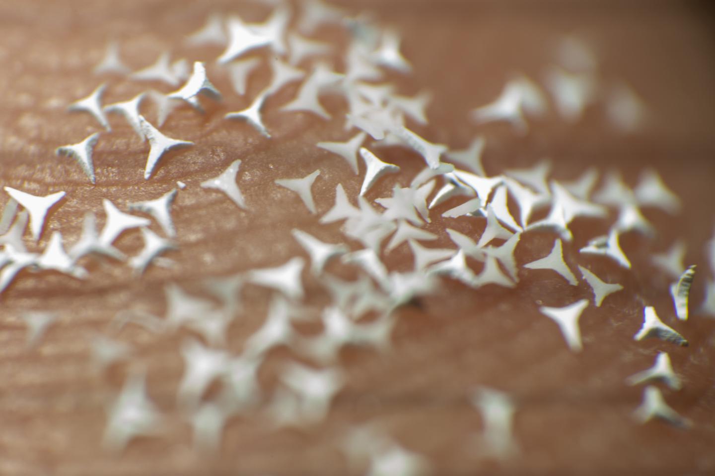 STAR particles mixed into a therapeutic cream