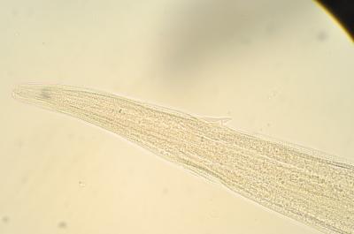 Front of <i>Haemonchus contortus</i> (Barber Pole) Worm
