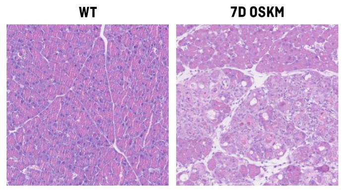 Vitamin B12 is a limiting factor for induced cellular plasticity and tissue repair