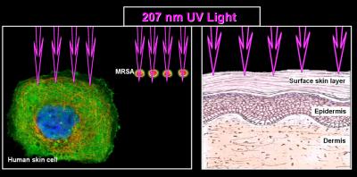 207-nm UV Light