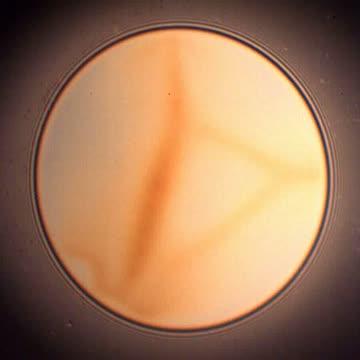 Drainage via stratification of micellar foam film