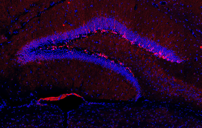 Mouse neurogenesis