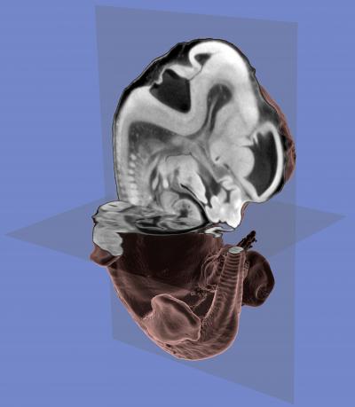Virtual Histology of Mouse Embryo
