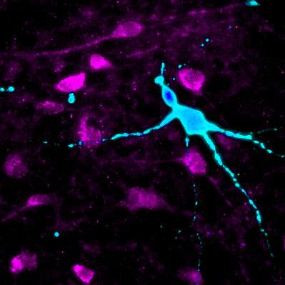 Two Types of iPSC-Derived Hypothalamic Neurons (1 of 2)
