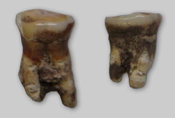 Mesolithic Tooth
