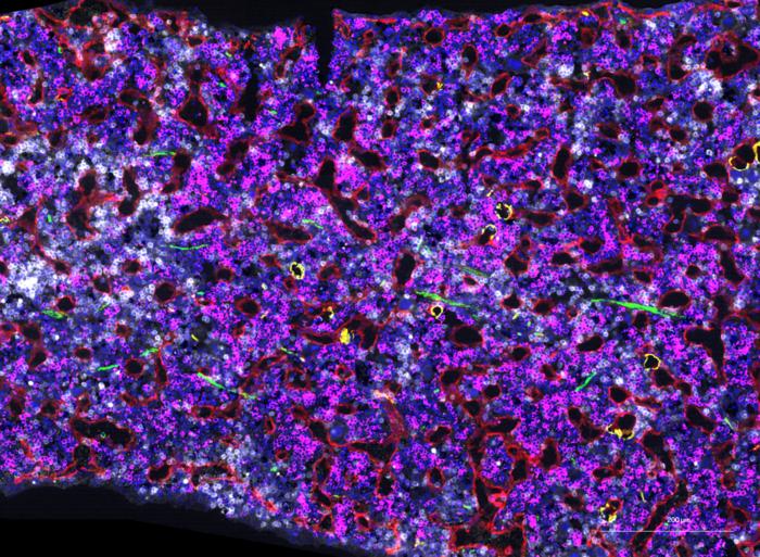 Blood cells in the bone marrow