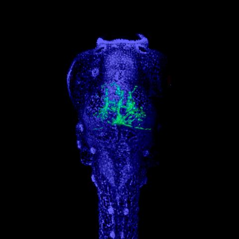 Zebrafish Embryo with Cancer Cells