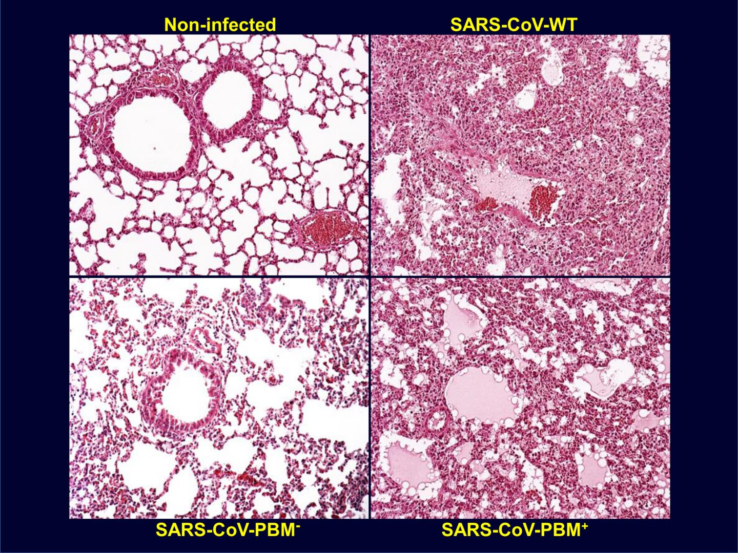 Lung Pathology of Mice Infected with SARS-CoV With or Without E Protein PBM
