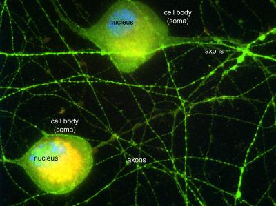 Virus-infected Neurons