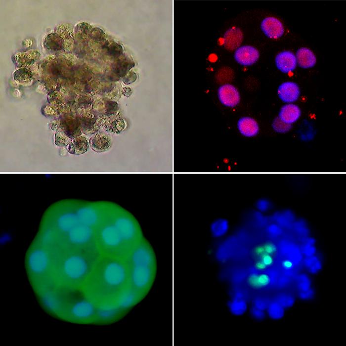 Microscopic images of human organoids with hepatocytes