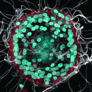 Stained colony of choanoflagellates