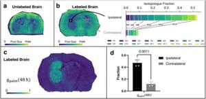 Spatial metabolomics images of a brain with a tumor.