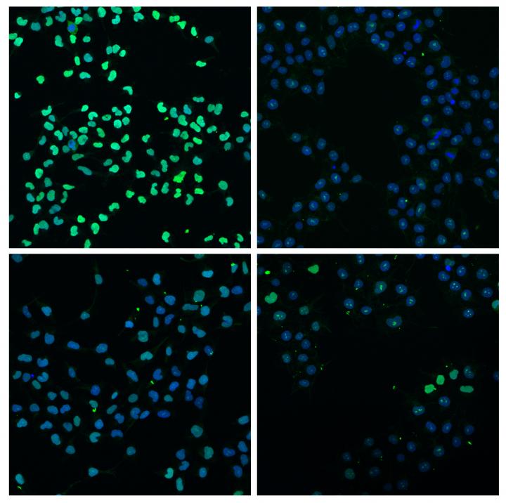 Two New Pathways in Stem Cell Growth Revealed