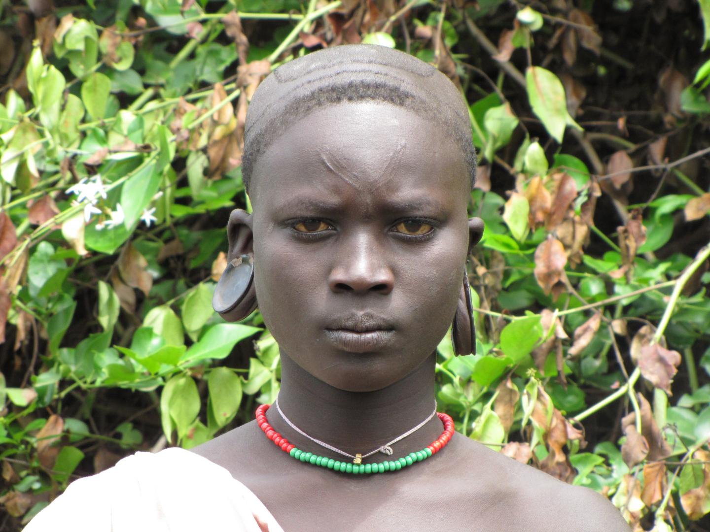 An Understanding of Pigmentation that is More than Just Skin Deep