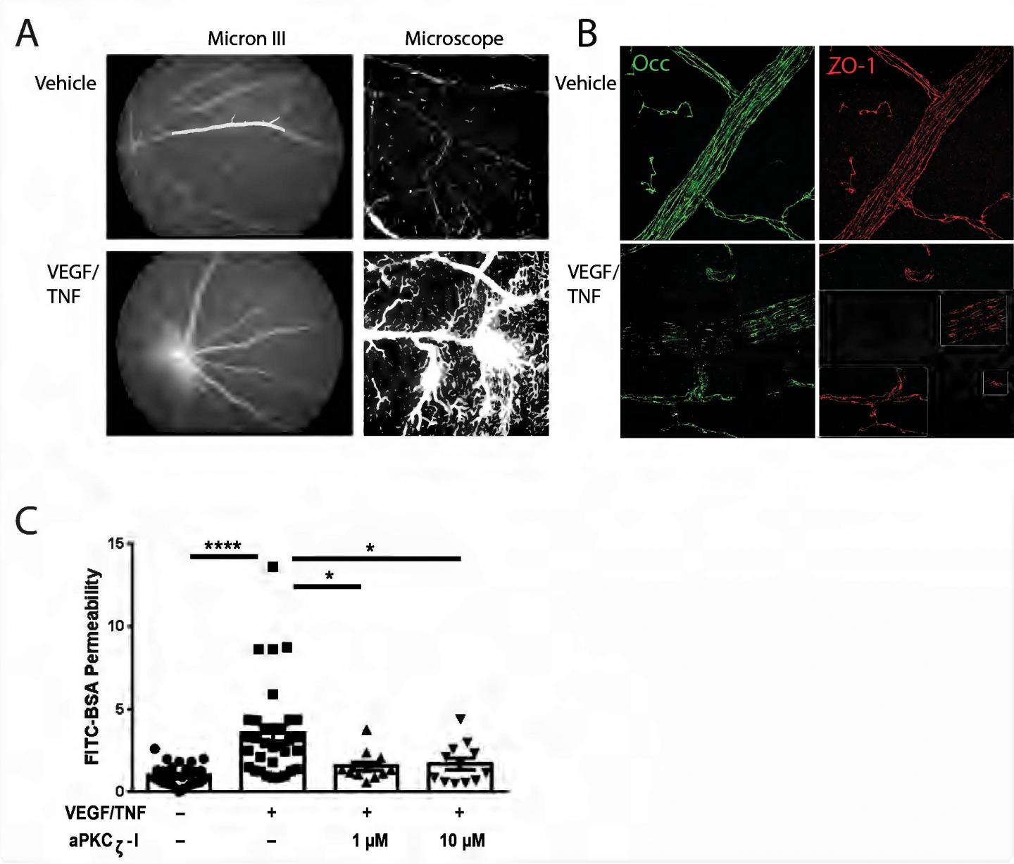 A Potential New Way to Treat Some of the Most Common Blinding Diseases