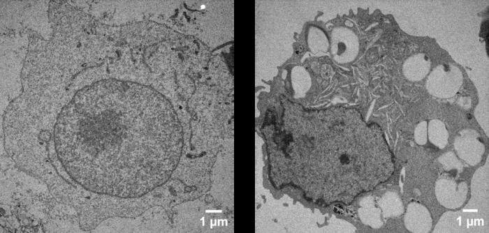 Cellular Nanoparticle Uptake