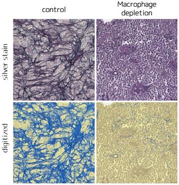 Vitamin D and Immune Cells Stimulate Bone Marrow Disease (Figure 2)