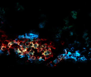 A transplanted pseudoislet made from CD63hi beta cells.