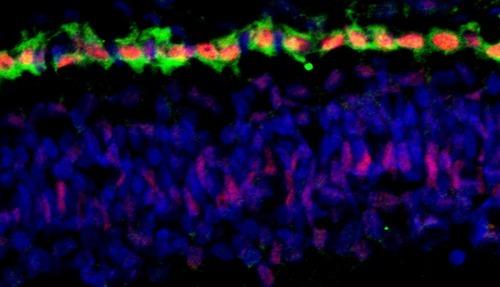 Cone Cells in the Retina