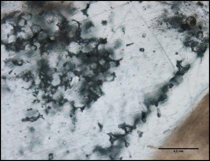 Teeth Tell the Story of People Who Didn't Get Enough Sunshine Centuries Ago