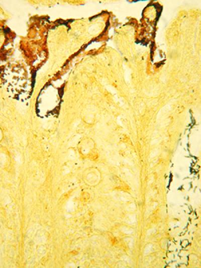 <I>Citrobacter rodentium</I>