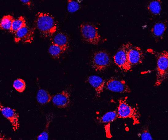 Human Beta Cells Induced to Undergo Senescence